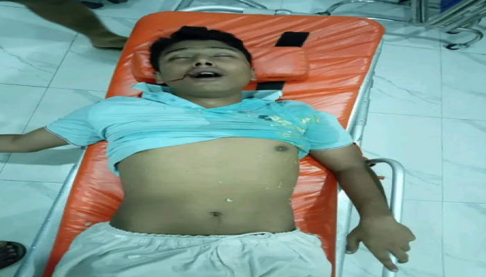 মাদকাসক্ত ব্যক্তির হামলায় আহত রবীন্দ্র বিশ্ববিদ্যালয়ের শিক্ষার্থী নিপুন।
