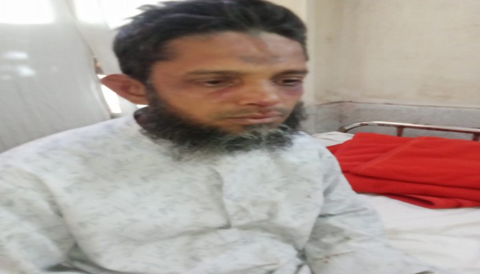 ​কাশিপুরে জামায়াত কর্মীকে প্রকাশ্যে পিটিয়ে জখম: সাবেক কাউন্সিলরসহ বিএনপি নেতাদের বিরুদ্ধে অভিযোগ