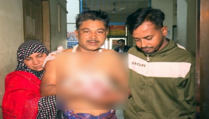 কুষ্টিয়ায় মহাসড়কে গাছের গুঁড়ি ফেলে ট্রাক থামিয়ে ডাকাতি, ডাকাতদের হামলায় চালক আহত