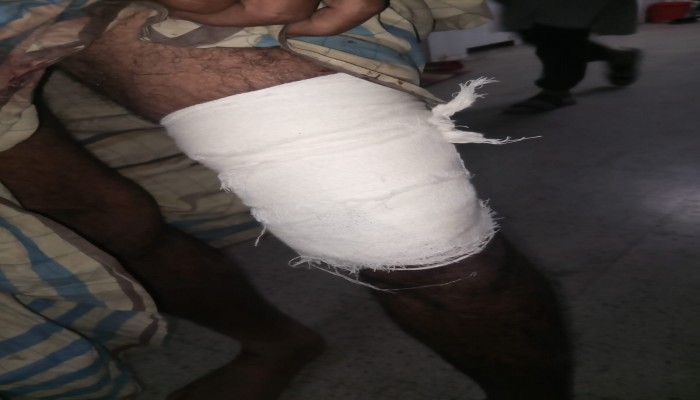 রাস্তা বন্ধের প্রতিবাদ করায় হামলা, থানায় মামলা