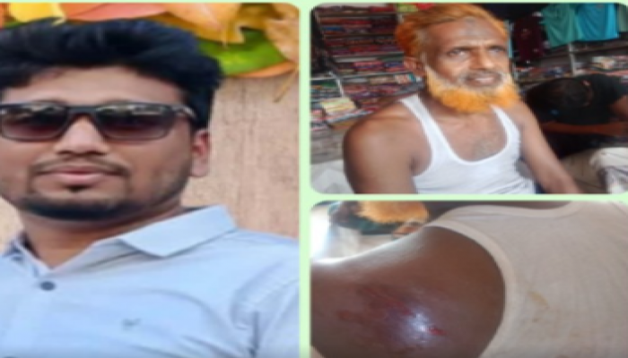 ​কয়রায় বিএনপি যুবদল কর্মীর হাতে গুরুতর আহত সভাপতি