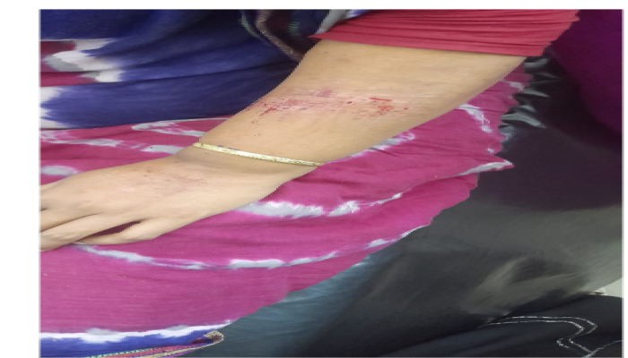 ​বোয়ালখালীতে দুুর্বৃত্তরা ৩ ঘন্টা তান্ডব চালিয়ে এক নারী আহত