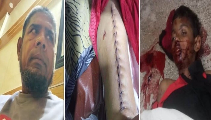 আনসার বাহিনীর গাড়ির ধাক্কায় শিশু নিহত'র ঘটনায় আজও পাইনি ক্ষতিপূরণ ভুক্তভোগী পরিবার 