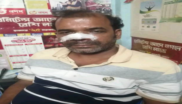 মরিচের গুঁড়ো ছুঁড়ে বিকাশ ব্যবসায়ীর টাকা ও মোবাইল লুট