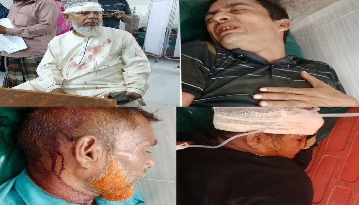 ব্রাহ্মণপাড়ায় দুই যানবাহনের মুখোমুখি সংঘর্ষে ৭ যাত্রী গুরুতর আহত