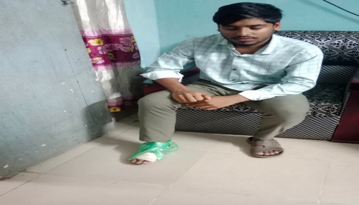 ব্রাহ্মণপাড়ায় 'ভু'ল চিকিৎসায়' স্কুলছাত্রের পায়ে প'চন, ডাক্তারের বি'রুদ্ধে থানায় অ'ভিযোগ