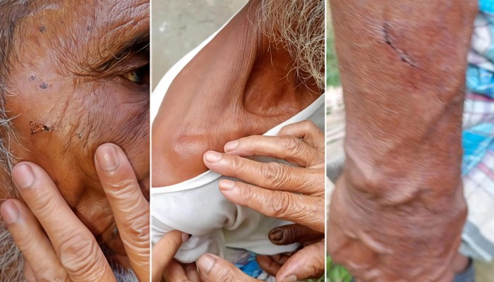 কালীগঞ্জে চাঁ'দা দা'বির অ'ভিযোগ: প্রবাসী ছেলেকে বাঁচাতে গিয়ে বৃ'দ্ধ বাবা-মা, স্ত্রীসহ আ'হত ৫