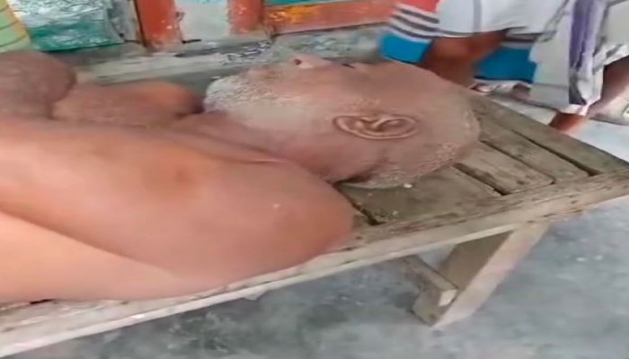 জাম পাড়তে গিয়ে গাছ থেকে পড়ে একজনের মৃত্যু