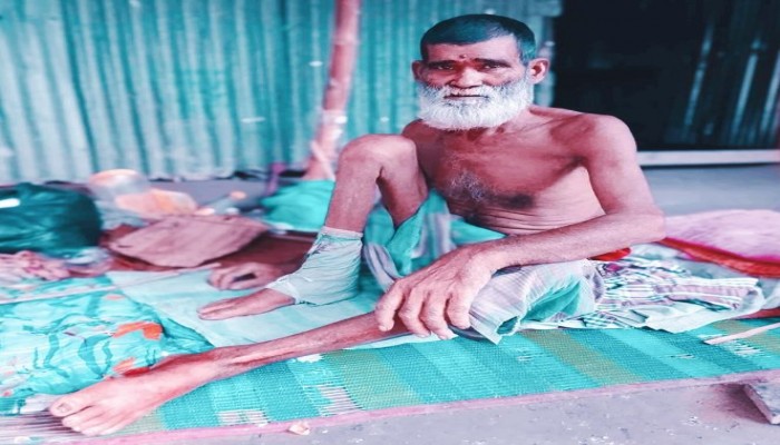 অর্থাভাবে চিকিৎসা করতে পাচ্ছে না অসহায় বৃদ্ধ সিরু মিয়ার।