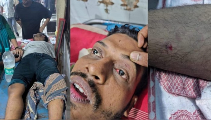 ইবি শিক্ষার্থীদের মারামারি, আহত ৪, পাল্টাপাল্টি অভিযোগ