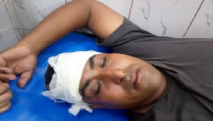 শহরে পূর্ব শত্রুতার জেড়ে এক রাজমিস্ত্রী ঠিকাদার কে কুপিয়ে রক্তাক্ত, মামলা দায়ের।