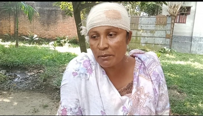 বদরগঞ্জে তুচ্ছ ঘটনায় নারীকে পিটিয়ে জখম, থানায় অভিযোগ