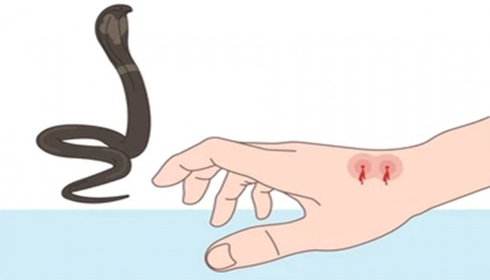 কুষ্টিয়ায় অ্যান্টিভেনম সংকটে সাপের কামড়ে ১ম দশ মাসে মৃত-০৮