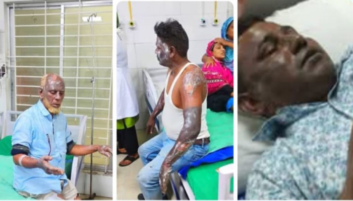 ‎প্রাইভেটকারে অগ্নিকান্ড কেন্দুয়ার ৪ জন দগ্ধ