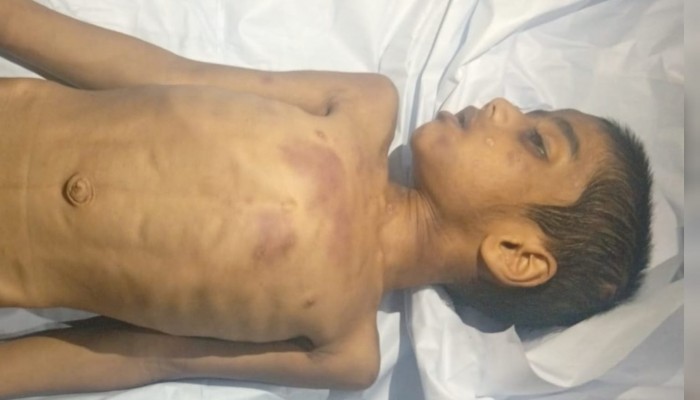 কালীগঞ্জে প্রতিবন্ধী শিশুর রহস্যজনক মৃত্যু, সৎ মায়ের বিরুদ্ধে সন্দেহ