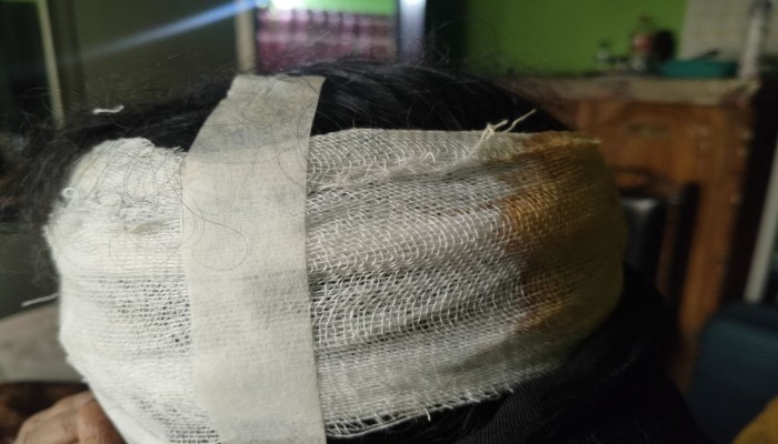 ঢাকা- ৪ আসনে গণসংযোগকালে জামায়াতের মহিলা নেত্রীর উপর রামদা দিয়ে হামলা