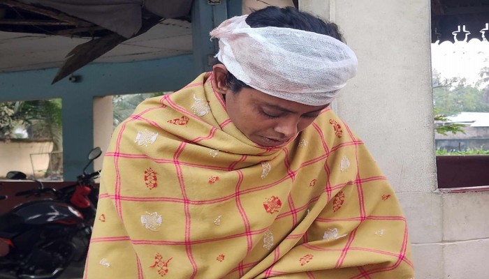 আত্রাই স্বামীর পরকীয়ার প্রতিবাদ করায় ভাসুরের হাতে রক্তাক্ত গৃহবধু