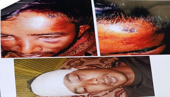 ​মিঠাপুকুরে জমি চাষ নিয়ে বিরোধ: ট্রাক্টর চালককে কুপিয়ে হত্যার চেষ্টা, ১০ দিনেও হয়নি মামলা