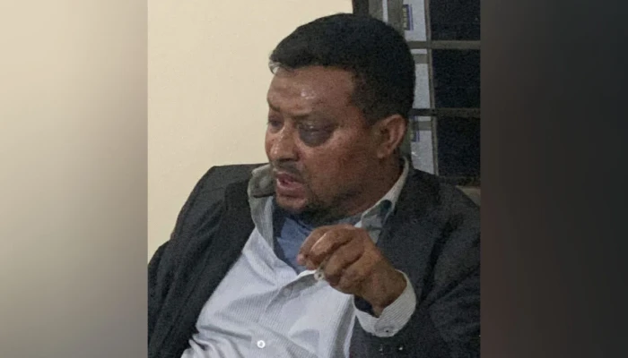 বিএনপি নেতার ওপর হামলার ২৮ দিন পর মামলা