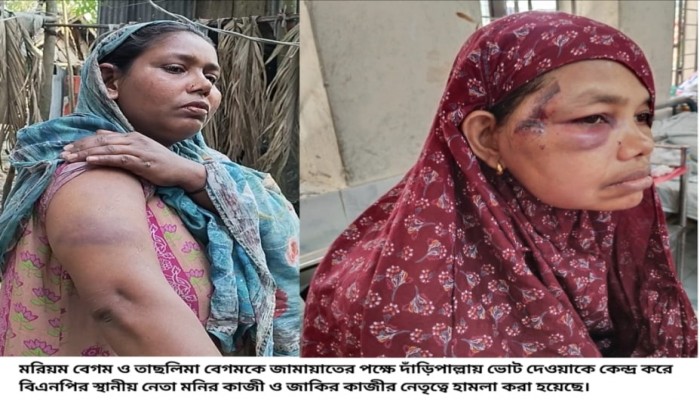 ​জামায়াতের দাঁড়িপাল্লায় ভোট দেওয়াকে কেন্দ্র করে রাজাপুরে তিন নারীকে পিটিয়ে আহত, মামলা দায়ের