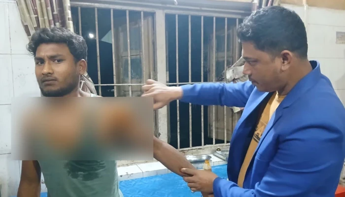 কুকুরের কামড়ে একদিনে শিশুসহ আহত ১৪, ভ্যাকসিন সংকটে ভোগান্তি