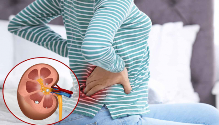 ঋতু বদলের সময় কিডনিতে পাথর হওয়ার ঝুঁকি বাড়ে কেন?