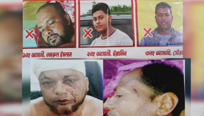 ​রূপগঞ্জে মৃত্যুর সাথে পাঞ্জা লড়েও উল্টো মামলার শিকার বাদলের পরিবার