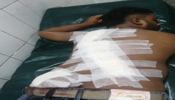 ​বুড়িচংয়ে মাদক বিক্রিতে বাধা দেয়ায় যুবককে কুপিয়ে গুরুতর জখম