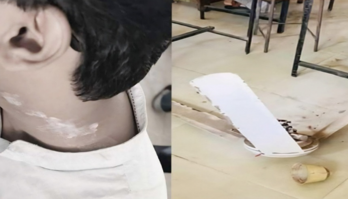 ​রুয়েটে শ্রেণিকক্ষে সিলিং ফ্যান পড়ে শিক্ষার্থী আহত