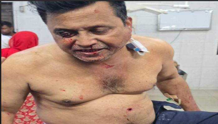 মিরপুরে দূর্বৃত্তদের গুলিতে আহত আওয়ামী লীগ নেতা