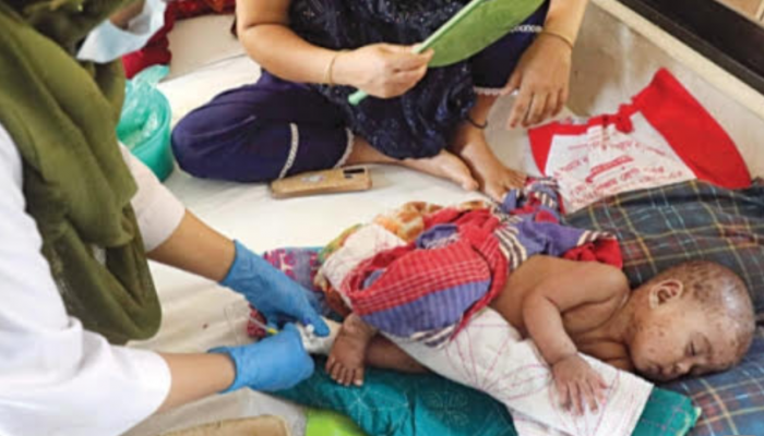 বরিশালে হামে  আরও দুই শিশুর মৃত্যু