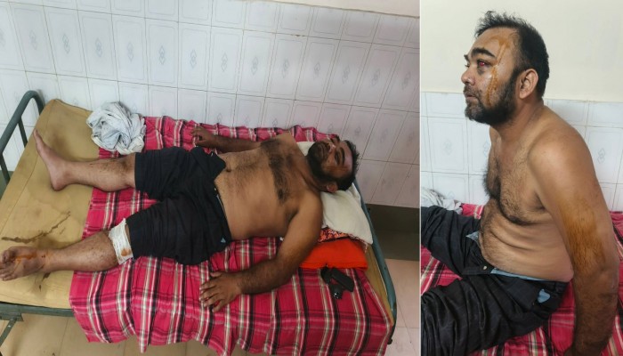 দিনাজপুরের ফুলবাড়ীতে ব্যবসায়ী দেলোয়ার হোসেন মামুন কে অপহরণ, মারপিট ও সাড়ে ৫ লক্ষ টাকা ছিন্তাই।