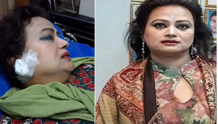 নায়িকার কান ছিঁড়ে দুল নিয়ে গেছে ছিনতাইকারী