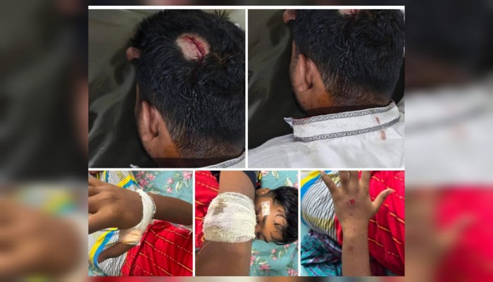 সাভারে বিশিষ্ট ব্যবসায়ী ও সমাজসেবক আনোয়ার হোসেনের বহরে হামলার অভিযোগ, কুপিয়ে আহত ৪