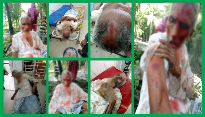 বানারীপাড়ায় চাঁদাবাজি মামলায় জামিনে বের হয়ে বাদীসহ তিনজনকে কুপিয়ে ও পিটিয়ে জখম