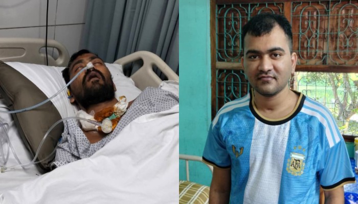 জীবন-মৃ'ত্যু'র সন্ধিক্ষণ পেরিয়ে সুস্থতার পথে বাকৃবি শিক্ষার্থী জীম