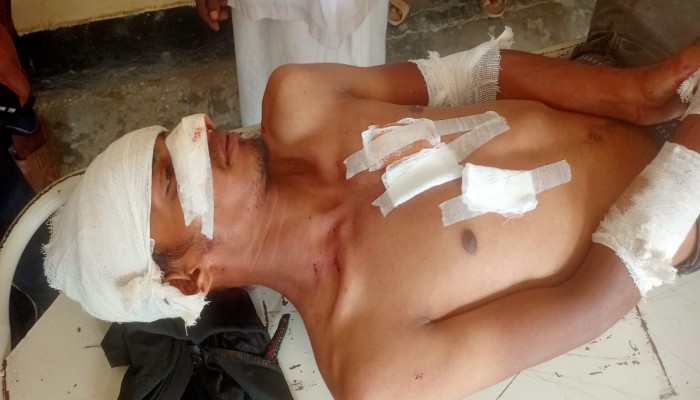 গলাচিপায় অটোরিকশা-মোটরসাইকেল মুখোমুখি সং'ঘ'র্ষে আ'হ'ত ৫